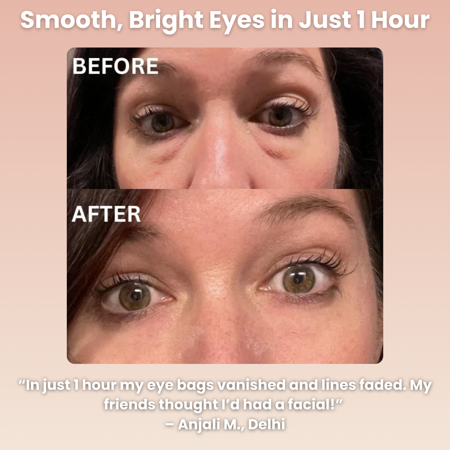 Instant Firming Under Eye Collagen Patches (8 Pairs)
