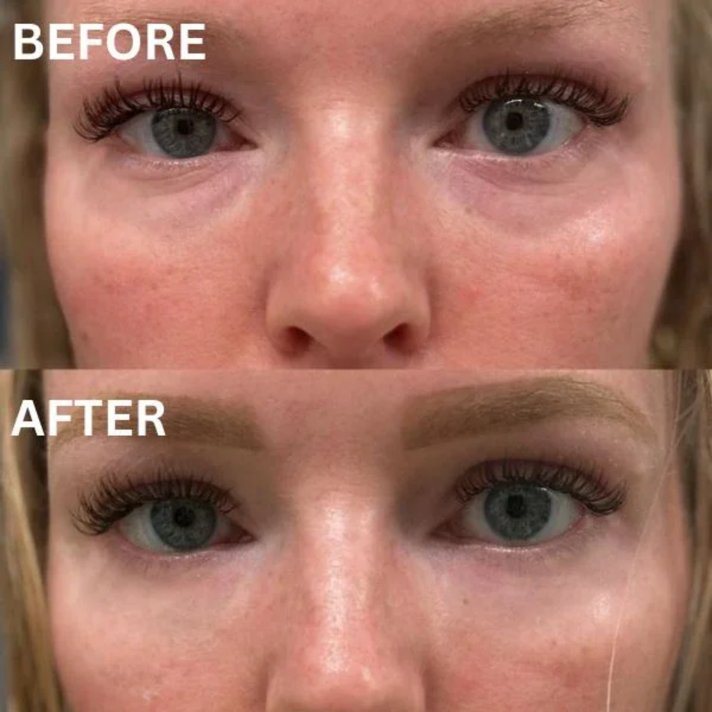 Instant Firming Under Eye Collagen Patches (8 Pairs)